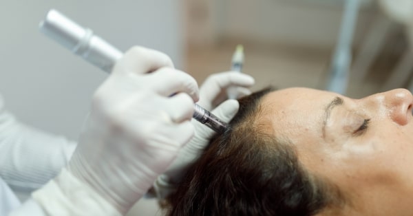Microneedling עבור קומפלקס שיער